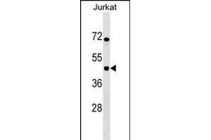 IKBIP Antibody (C-term) (ABIN1537125 and ABIN2849210) western blot analysis in Jurkat cell line lysates (35 μg/lane). (IKbIP Antikörper  (C-Term))