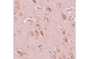 Immunohistochemistry of FAM59B in human brain tissue with FAM59B antibody at 5 μg/ml. (FAM59B Antikörper  (C-Term))