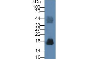 Detection of RNASE2 in Human Urine using Polyclonal Antibody to Ribonuclease A2 (RNASE2) (RNASE2 Antikörper  (AA 28-161))