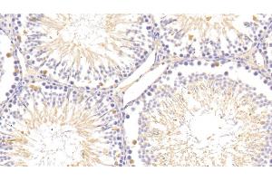 Detection of SAP in Rat Testis Tissue using Polyclonal Antibody to Serum Amyloid P Component (SAP)