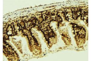 ABIN6267292 at 1/100 staining Mouse colon tissue by IHC-P. (p53 Antikörper  (pSer366))