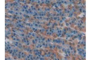Immunohistochemistry (IHC) image for anti-Selectin P (Granule Membrane Protein 140kDa, Antigen CD62) (SELP) (AA 58-158) antibody (ABIN7432088)