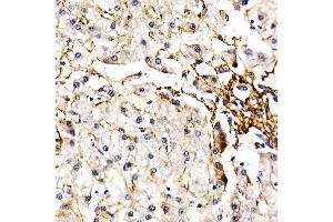 Immunohistochemistry of paraffin-embedded human liver using FBN1 Rabbit pAb (ABIN7267176) at dilution of 1:50 (40x lens). (Fibrillin 1 Antikörper  (AA 360-460))