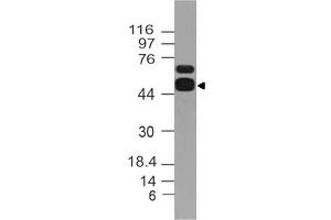 Image no. 1 for anti-Aldehyde Dehydrogenase 1 Family, Member A1 (ALDH1A1) (AA 300-500) antibody (ABIN5027482) (ALDH1A1 Antikörper  (AA 300-500))
