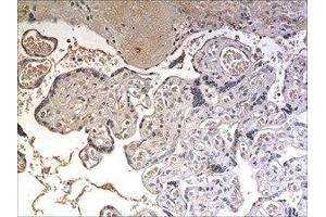 Immunohistochemistry (IHC) image for anti-Agouti Related Protein Homolog (Mouse) (AGRP) (AA 21-132) antibody (ABIN1982999)