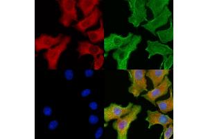 ABIN6260629 and ABIN6276912 staining Hela cells by IF/ICC.