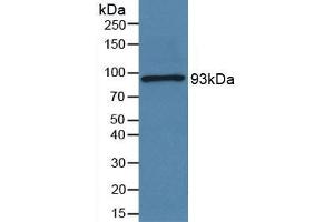 Western Blotting (WB) image for Periostin (POSTN) ELISA Kit (ABIN6574325)