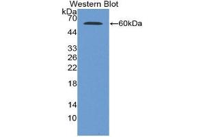 Western Blotting (WB) image for anti-Glucose-6-Phosphate Dehydrogenase (G6PD) (AA 1-515) antibody (ABIN1078069) (Glucose-6-Phosphate Dehydrogenase Antikörper  (AA 1-515))