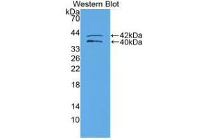 Western blot analysis of recombinant Human IGFBP1. (IGFBPI Antikörper  (AA 159-249))