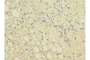 Immunohistochemistry of paraffin-embedded human liver tissue using ABIN7154045 at dilution of 1:100 (GATC Antikörper  (AA 1-136))