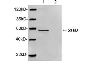 Western blot analysis of HEK293 cell lysate using 1 µg/mL Rabbit Anti-Vimentin Polyclonal Antibody (ABIN398717) Primary Antibody: Lane 1: Rabbit Anti-Vimentin Polyclonal AntibodyLane 2: Rabbit Anti-Vimentin Polyclonal Antibody pre-incubated with immunizing peptideThe signal was developed with IRDyeTM 800 Conjugated Goat Anti-Rabbit IgG (Vimentin Antikörper  (AA 70-120))