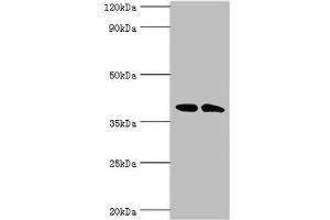 Western blot All lanes: Casein kinase I isoform alpha-like antibody at 4 μg/mL Lane 1: K562 whole cell lysate Lane 2: Hela whole cell lysate Secondary Goat polyclonal to rabbit IgG at 1/10000 dilution Predicted band size: 39 kDa Observed band size: 39 kDa