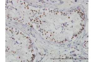 Immunoperoxidase of monoclonal antibody to HDAC1 on formalin-fixed paraffin-embedded human testis. (HDAC1 Antikörper  (AA 1-482))