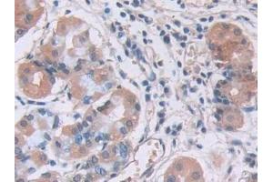 Detection of IL12A in Human Stomach Tissue using Monoclonal Antibody to Interleukin 12A (IL12A) (IL12A Antikörper  (AA 23-219))