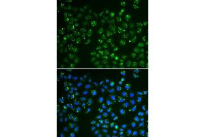 Immunofluorescence analysis of A549 cell using GPX4 antibody. (GPX4 Antikörper  (AA 30-197))