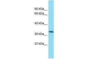 Host: Rabbit Target Name: TMEM241 Sample Type: NCI-H226 Whole Cell lysates Antibody Dilution: 1. (TMEM241 Antikörper  (C-Term))