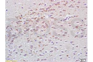Formalin-fixed and paraffin embedded rat brain tissue labeled with Anti-Tubulin-alpha Polyclonal Antibody, Unconjugated (ABIN725630) at 1:200, followed by conjugation to the secondary antibody and DAB staining (alpha Tubulin Antikörper  (AA 375-448))