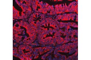 IF analysis of EML4 using anti-EML4 antibody (ABIN6719384). (EML4 Antikörper  (AA 207-423))