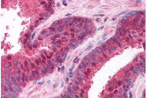 Human Prostate (formalin-fixed, paraffin-embedded) stained with PPP4C antibody ABIN214615 at 10 ug/ml followed by biotinylated goat anti-rabbit IgG secondary antibody ABIN481713, alkaline phosphatase-streptavidin and chromogen. (PPP4C Antikörper  (AA 294-307))