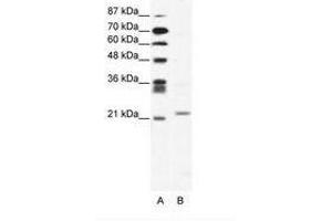 Image no. 1 for anti-Twist Homolog 1 (Drosophila) (TWIST1) (C-Term) antibody (ABIN202060)