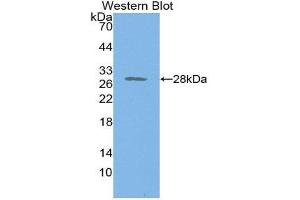 Western Blotting (WB) image for anti-Proteasome 26S Subunit, Non ATPase 9 (AA 2-223) antibody (ABIN1860343) (Proteasome 26S Subunit, Non ATPase 9 (AA 2-223) Antikörper)