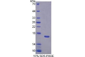 Image no. 1 for Bactericidal/Permeability Increasing Protein (BPI) (AA 320-457) protein (His tag) (ABIN4988638) (BPI Protein (AA 320-457) (His tag))