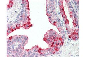 Anti-CUTA antibody IHC staining of human prostate. (CUTA Antikörper  (AA 185-195))