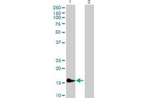 Western Blot analysis of PLA2G16 expression in transfected 293T cell line by PLA2G16 MaxPab polyclonal antibody. (PLA2G16 Antikörper  (AA 1-162))