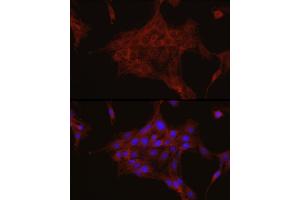 Immunofluorescence analysis of PC-12 cells using TGF beta induced (TGFBI) Rabbit pAb (ABIN3023372, ABIN3023373, ABIN3023374 and ABIN6219663) at dilution of 1:50 (40x lens). (TGFBI Antikörper  (AA 481-683))