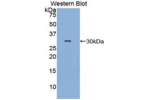 Western Blotting (WB) image for anti-DNA Fragmentation Factor, 40kDa, beta Polypeptide (Caspase-Activated DNase) (DFFB) (AA 87-323) antibody (ABIN3207309) (DFFB Antikörper  (AA 87-323))