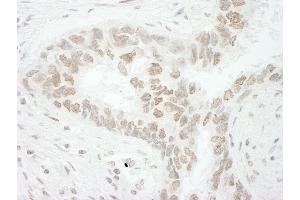 Immunohistochemistry (IHC) image for anti-CD3e Molecule, epsilon Associated Protein (CD3EAP) (AA 404-454) antibody (ABIN7448916) (CD3EAP Antikörper  (AA 404-454))