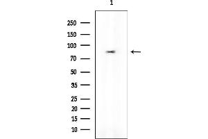 anti-X-Ray Radiation Resistance Associated 1 (XRRA1) antibody