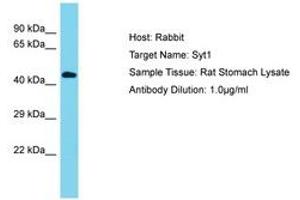 Image no. 1 for anti-Synaptotagmin I (SYT1) (AA 104-153) antibody (ABIN6750420) (SYT1 Antikörper  (AA 104-153))