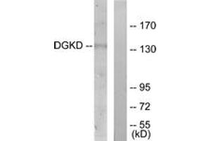 Western blot analysis of extracts from HuvEc cells, using DGKD Antibody. (DGKD Antikörper  (AA 41-90))