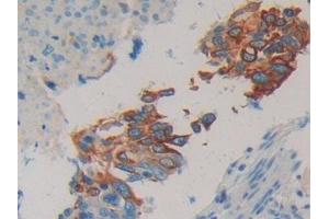 Detection of CK 20 in Human Lung Tissue using Polyclonal Antibody to Cytokeratin 20 (CK 20) (KRT20 Antikörper  (AA 9-424))