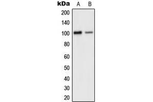 Western blot analysis of GLUR2 expression in human brain (A), mouse cortex (B) whole cell lysates. (GRIA2 Antikörper  (C-Term))