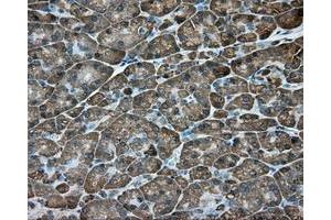 Immunohistochemical staining of paraffin-embedded Kidney tissue using anti-ACSBG1 mouse monoclonal antibody. (ACSBG1 Antikörper)