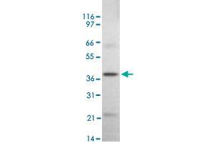 Western blot analysis of DAPK2 in rat kidney tissue lysate using DAPK2 polyclonal antibody  at 2 ug/mL . (DAPK2 Antikörper  (AA 325-342))