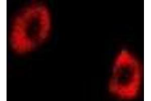 Immunofluorescent analysis of GRP75 staining in U2OS cells. (HSPA9 Antikörper)