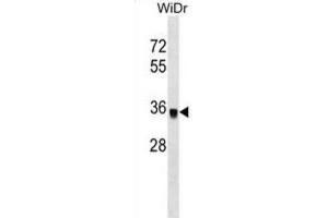 Western Blotting (WB) image for anti-Protein Phosphatase 1, Catalytic Subunit, gamma Isoform (PPP1CC) antibody (ABIN2999122) (PPP1CC Antikörper)