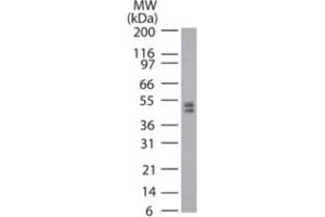 Western blot analysis of Trdmt1 in mouse ES cell lysate using Trdmt1 polyclonal antibody  at 2 ug/mL . (Dnmt2 Antikörper  (AA 39-53))