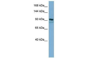 FAM62B antibody used at 1 ug/ml to detect target protein.
