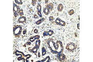 IHC analysis of WDR1 using anti-WDR1 antibody (ABIN4886763). (WDR1 Antikörper  (C-Term))