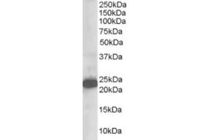 Western Blotting (WB) image for anti-Stathmin-Like 2 (STMN2) (N-Term) antibody (ABIN2465312) (STMN2 Antikörper  (N-Term))