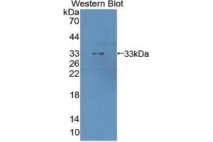 Western blot analysis of the recombinant protein. (Cathepsin Z Antikörper  (AA 34-291))
