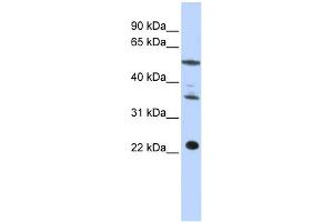 WB Suggested Anti-CENPM Antibody Titration:  0. (CENPM Antikörper  (Middle Region))