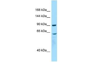 WB Suggested Anti-WHAMM Antibody Titration: 1. (WHAMM Antikörper  (C-Term))