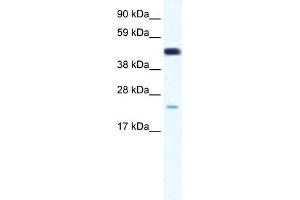 WB Suggested Anti-TCF7 Antibody Titration:  0. (TCF7 Antikörper  (Middle Region))