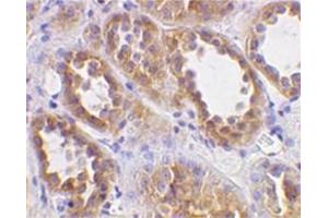 Image no. 1 for anti-Angiotensin I Converting Enzyme 2 (ACE2) (N-Term) antibody (ABIN319091) (ACE2 Antikörper  (N-Term))