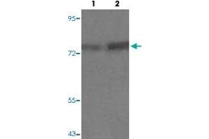 Western blot analysis of Lane 1: PC12 cells, Lane 2: PMA treated PC12 cells with PRKCQ (phospho S676) polyclonal antibody  at 1:500-1:1000 dilution. (PKC theta Antikörper  (pSer676))
